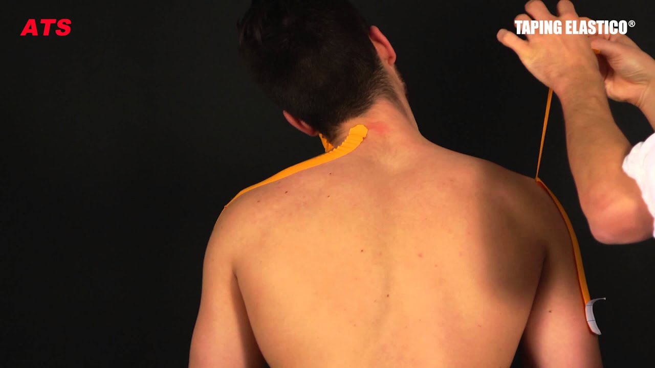 Taping Elastico® - Applicazione Cervicale
