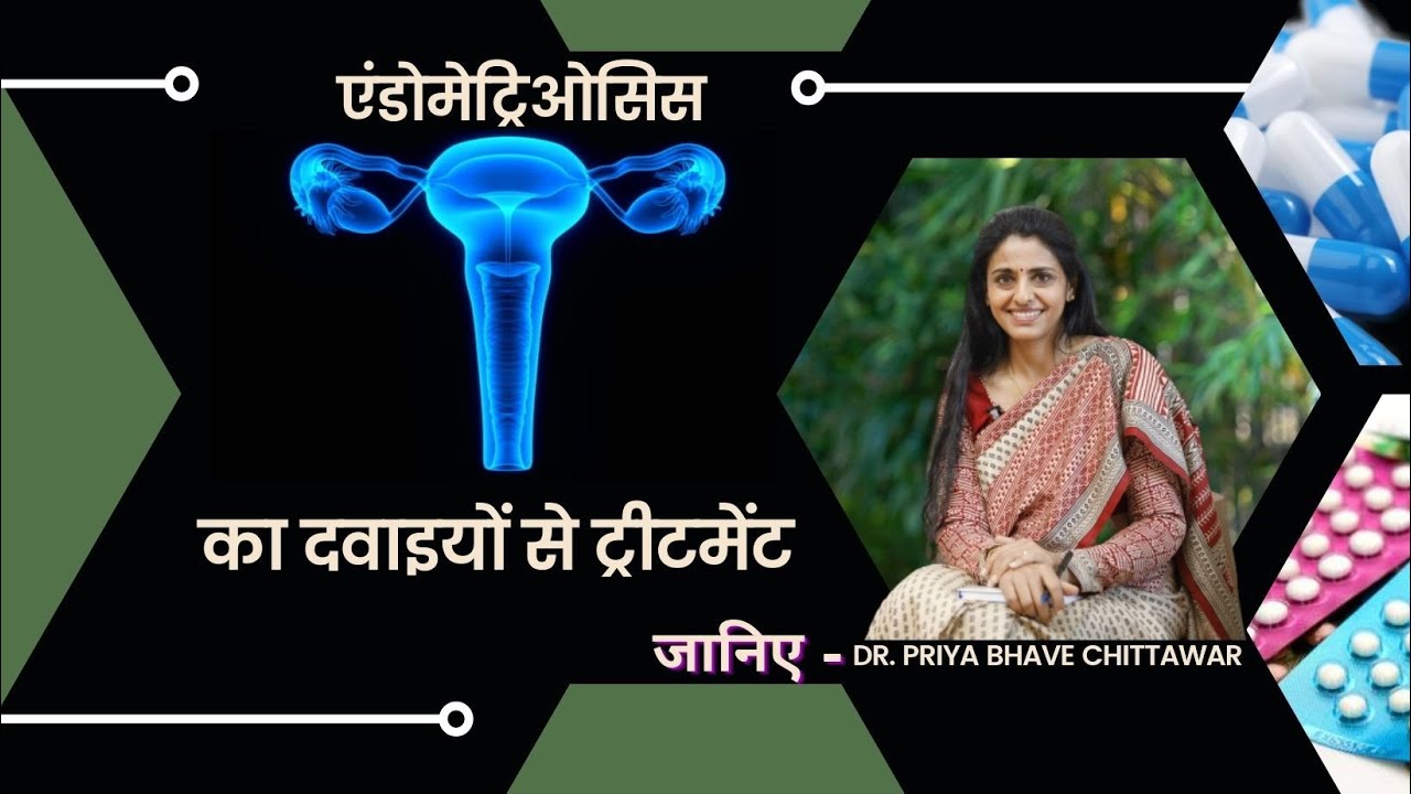एंडोमेट्रिओसिस  का दवाइयों से ट्रीटमेंट  Dr. Priya Bhave Chittawar