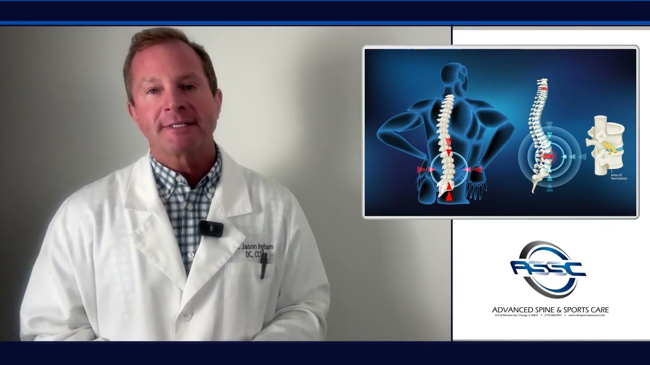 Herniated Disc Treatment Options: Effective Solutions for Pain Relief