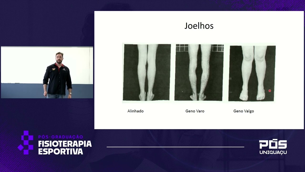 Avaliação do Pé e Joelho Considerações sobre Postura e Alinhamento - Dr. Rodrigo Fenner
