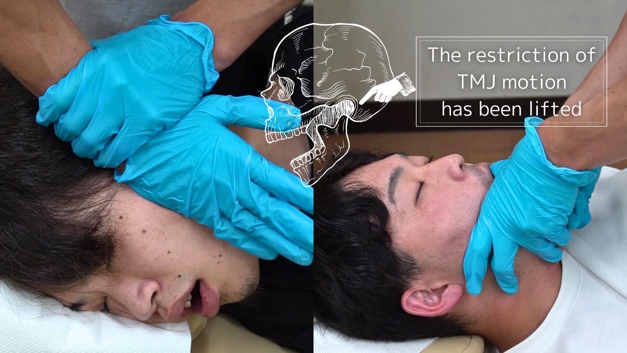 【ASMR chiro cracking 全身ボキボキ整体】(TMJ収録)開口制限・顎の偏位への施術依頼増えてきました！Full body adjustment from Japan +Y-strap