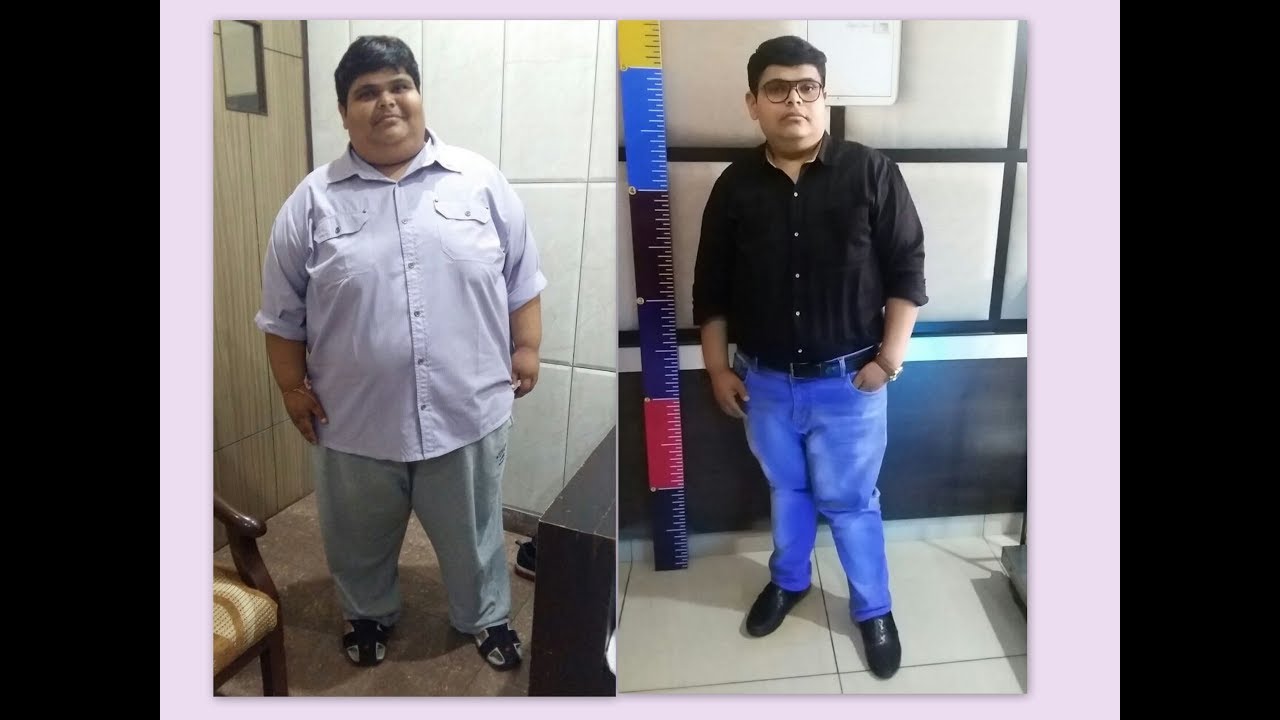 I Lost 70 Kg after MGB and still losing|Best Weight Loss Surgery|Punjab|India|Dr. Kular