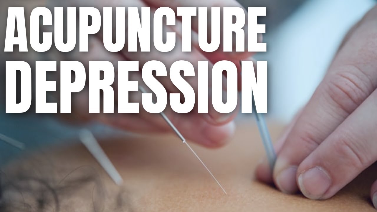 Acupuncture For Depression - Control Your Anxiety Through Acupuncture Treatments