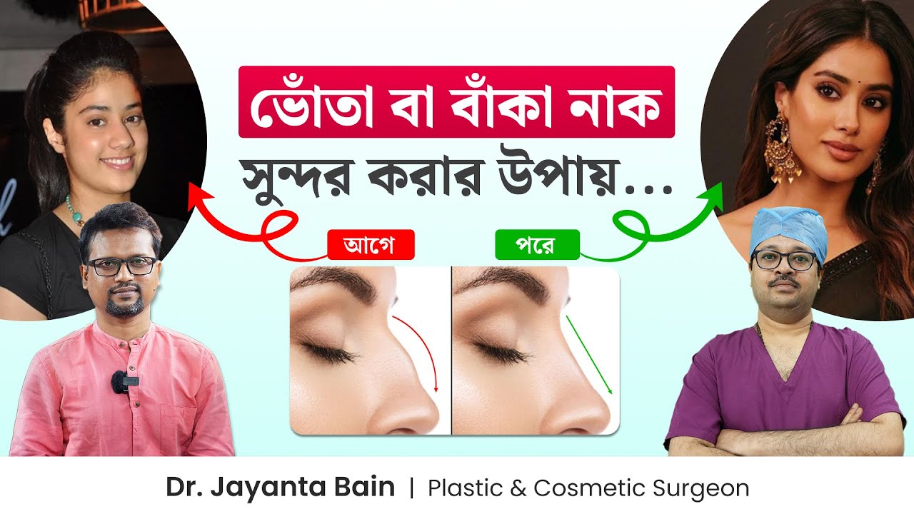 মোটা নাক সরু বা বাঁকা নাক ঠিক করার উপায় | রাইনোপ্লাস্টি: নাক সুন্দর করার পদ্ধতি - Dr. Jayanta Bain