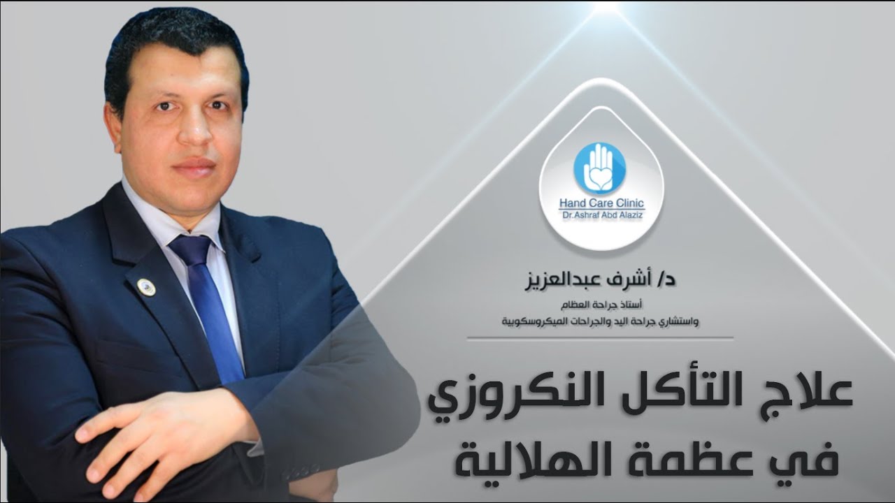 علاج التأكل النكروزي في عظمة الهلالية - دكتور أشرف عبدالعزيز