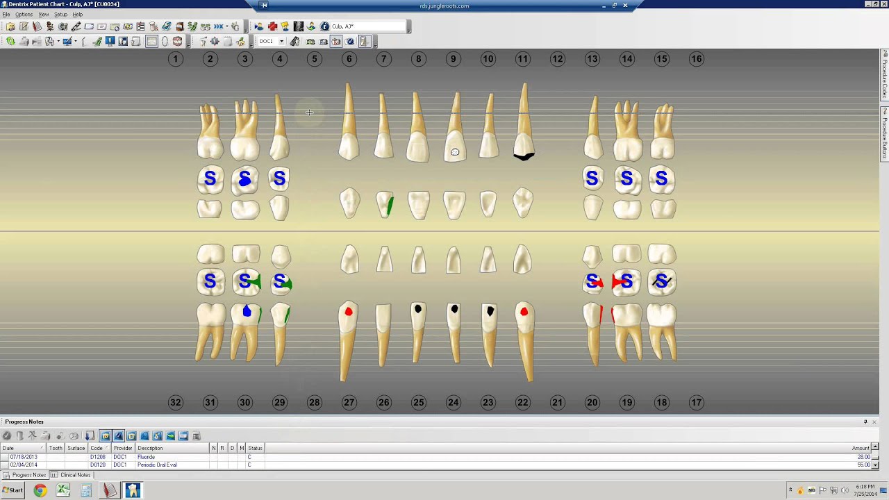 Dentrix Intro
