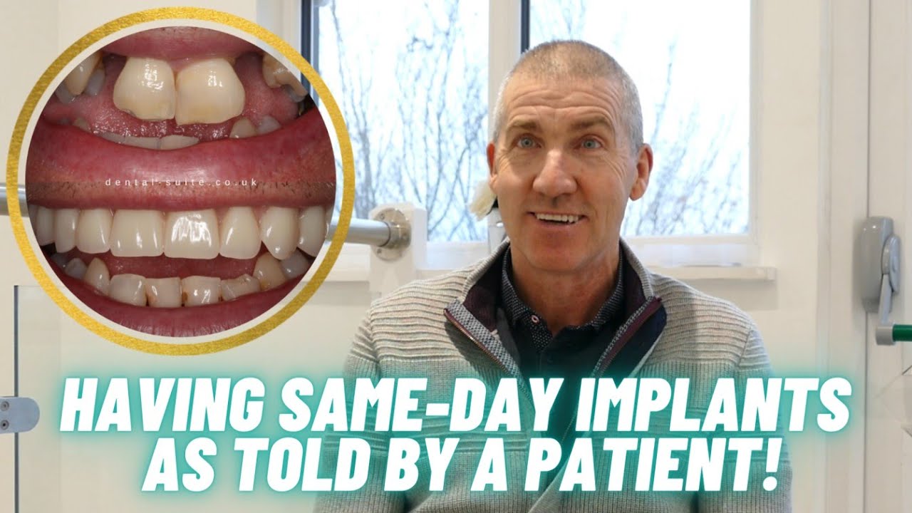 Having same-day dental implant treatment | A patient experience