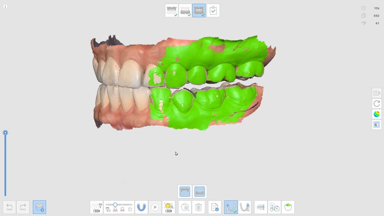 Multi Occlusion (ENG)
