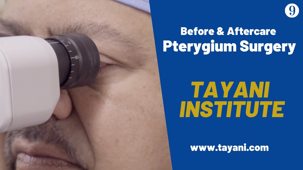 Before & After Pterygium Surgery | Tayani Institute