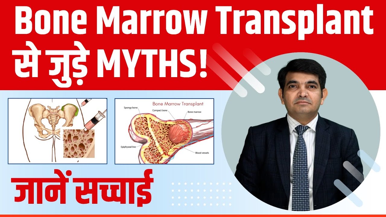 Myths about Bone Marrow Transplants | Dr. Atish Bakane