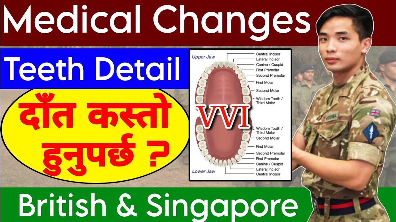 Teeth Criteria For British & Singapore Selection // Most Confusing // GORKHALI