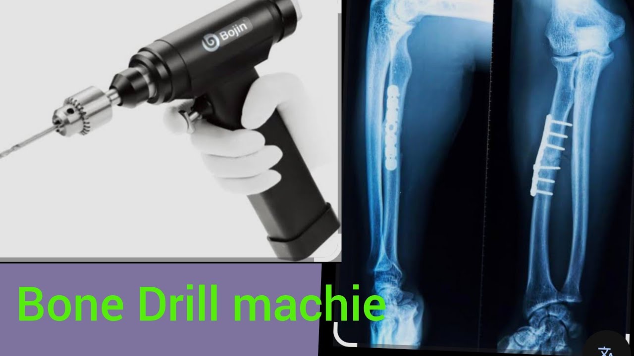 January 1, 2026 Orthopadic bone Drill machine 