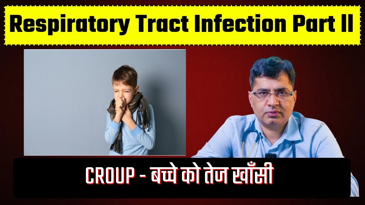 क्या आपके बच्चे को तेज खाँसी हो रही है ? | RTI Respiratory Tract Infection Part ll - (CROUP)
