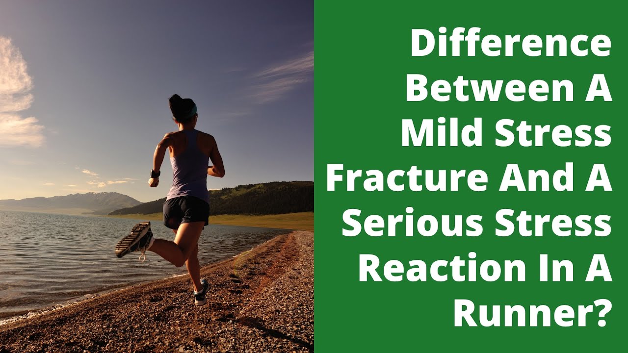Difference Between A Mild Stress Fracture And A Serious Stress Reaction In A Runner?