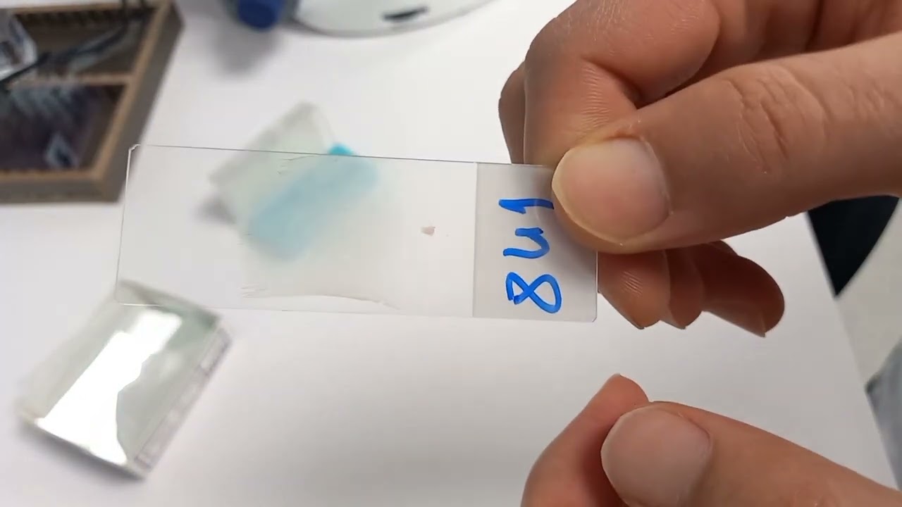 frottis sanguin + coloration Mgg #hématologie