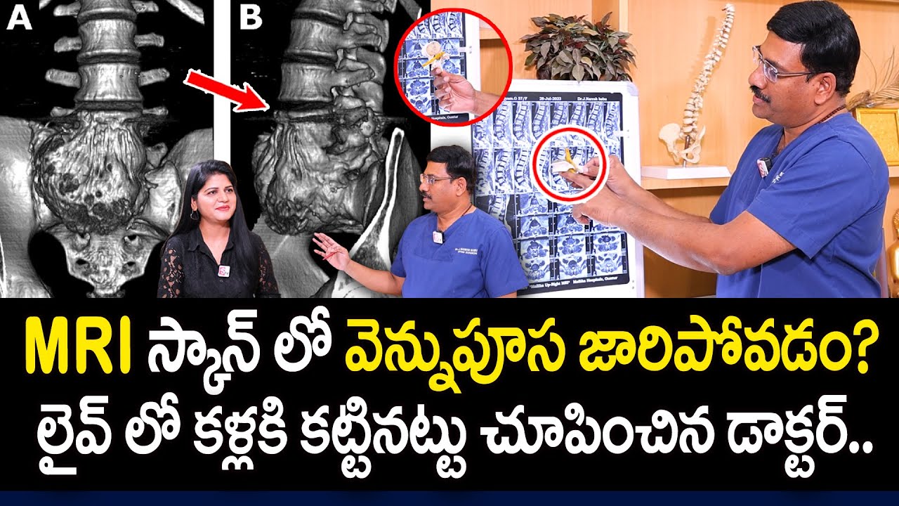 What is MRI Scan in Telugu? | Disc Problems | Mallika Hospital | Dr. Naresh Babu | PlayEven