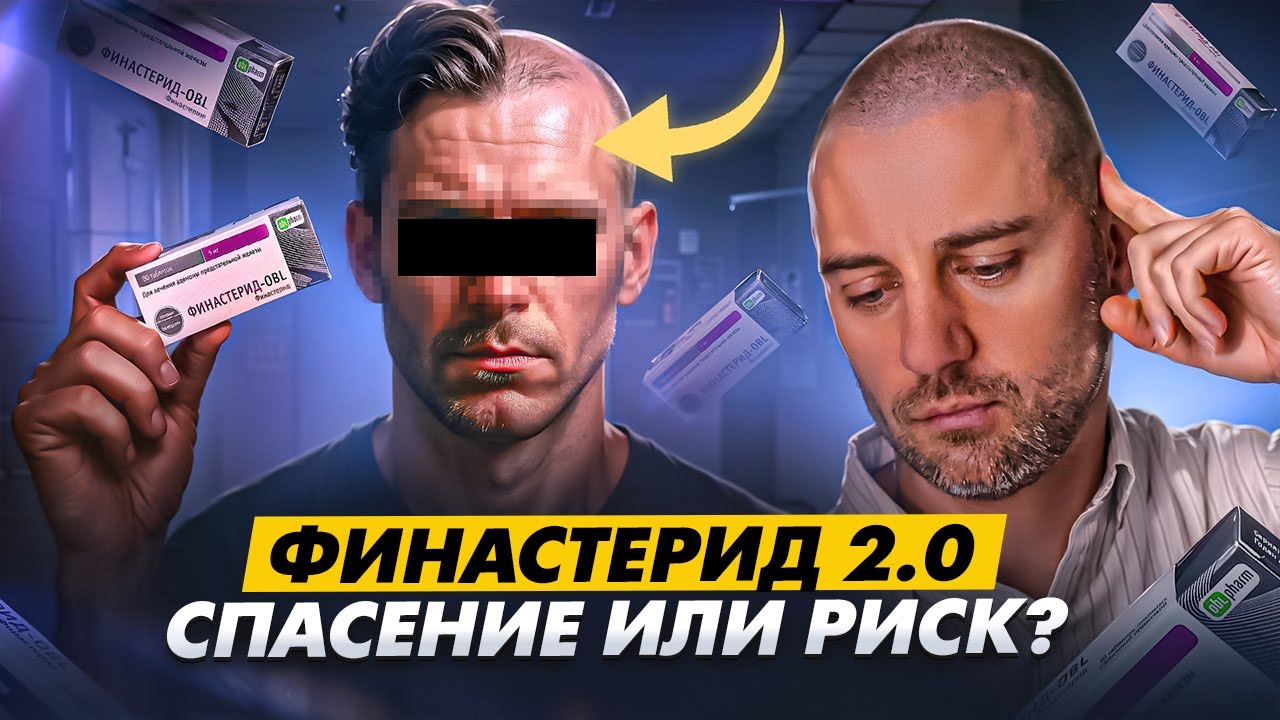 ФИНАСТЕРИД 2.0 Как спасти результат пересадки: план лечения