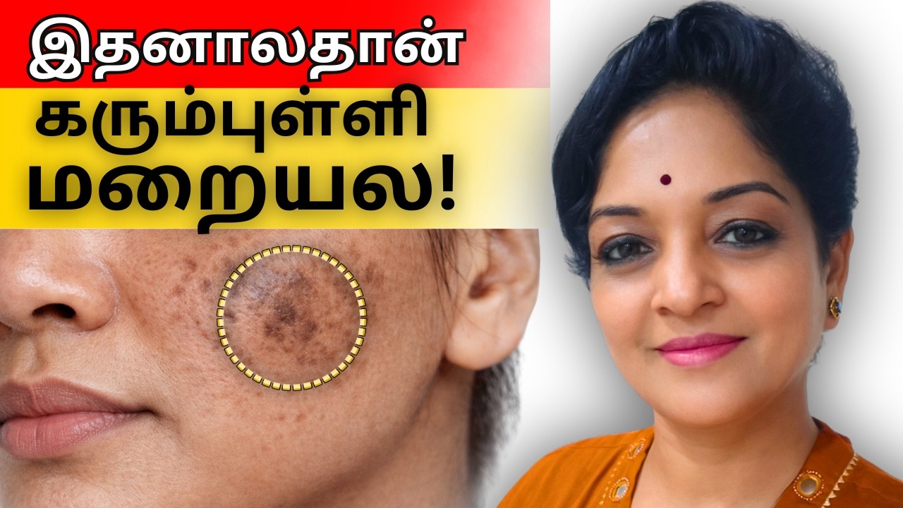 கரும்புள்ளி திரும்பத் திரும்ப வருதா?  இந்த தவறை செய்யாதீங்க | Tamil Health Tips