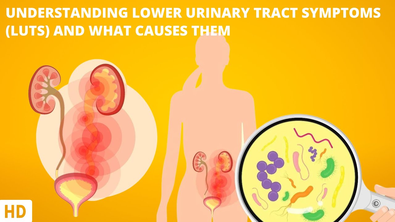 Understanding Lower Urinary Tract Symptoms