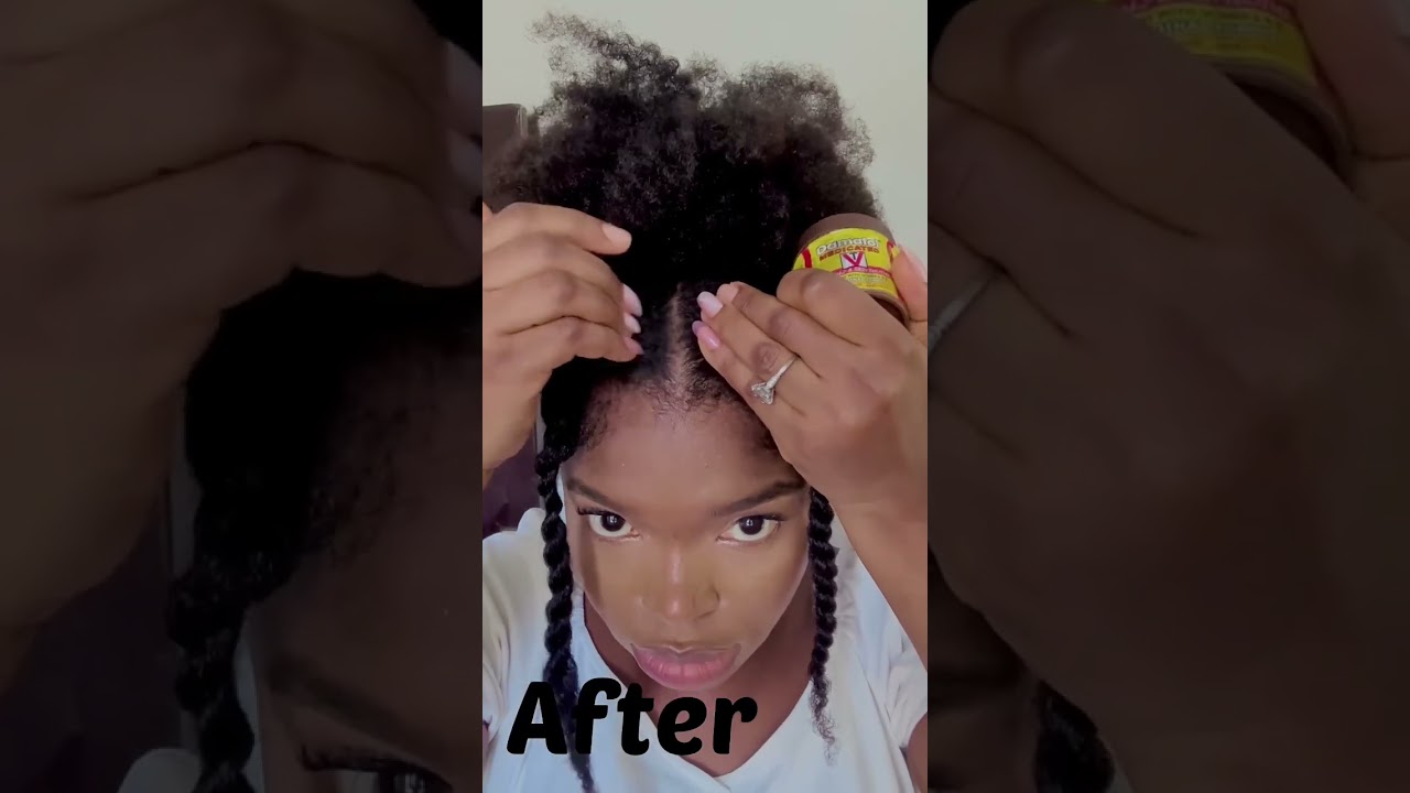 Grow back thinning edges #growedgesfast