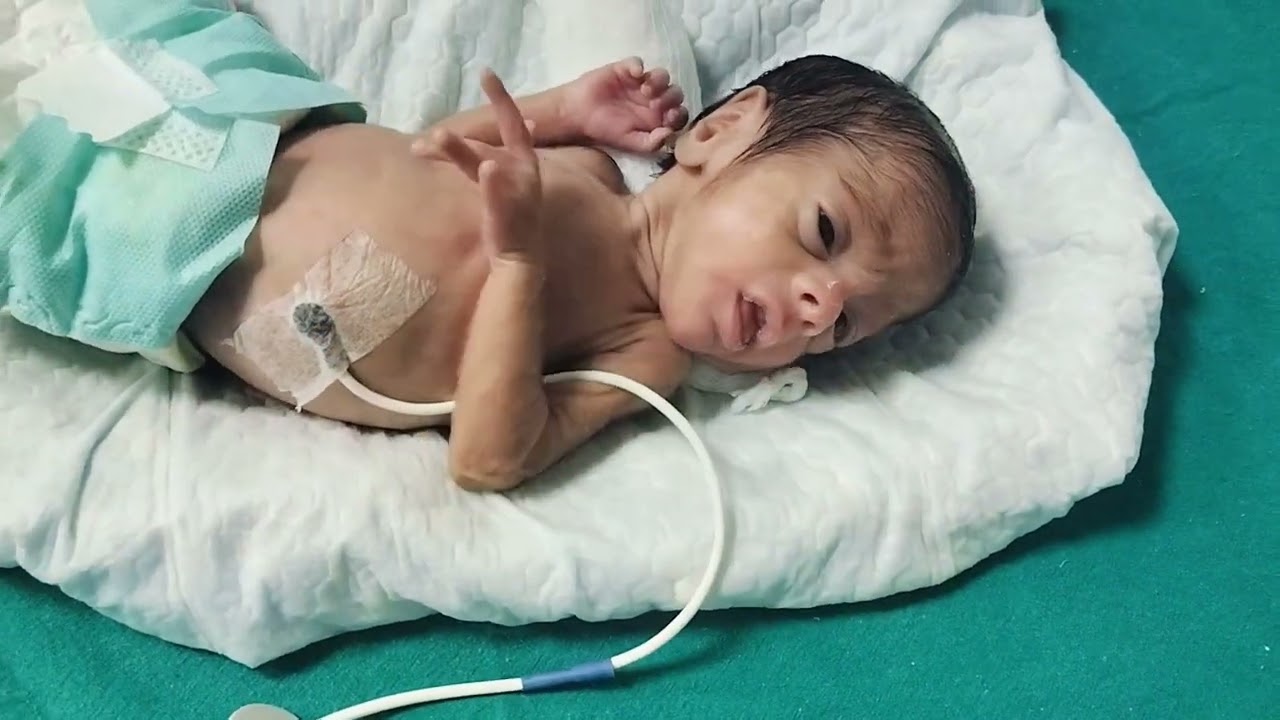 # 31 weak # preterm