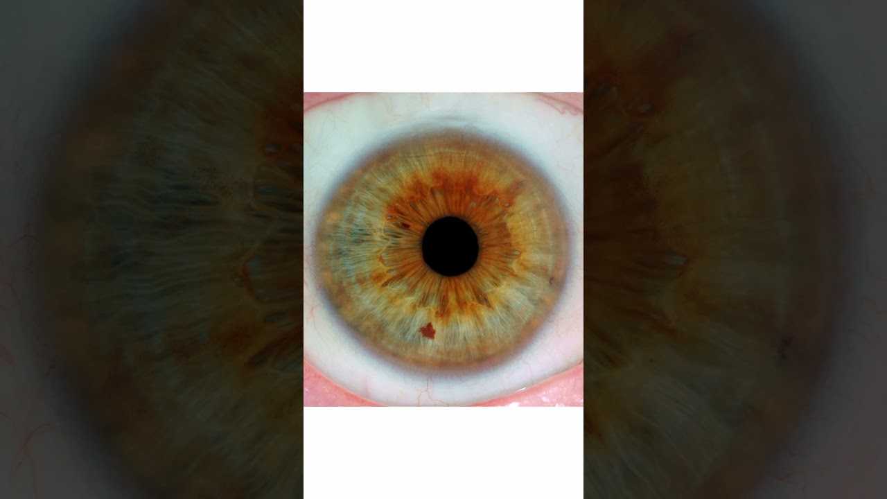 The behavioural model of iridology and iris analysis