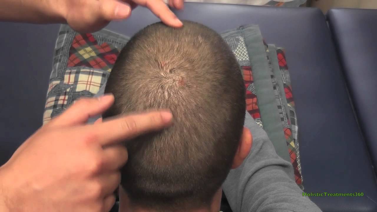 ASMR - Head & Scalp Gentle Tapping and Tickle Massage - Very Relaxing