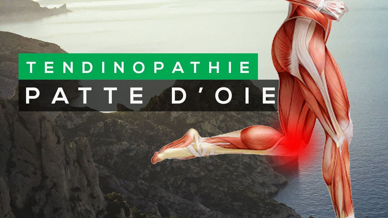 COMMENT TRAITER LA TENDINITE DE LA PATTE D'OIE ?
