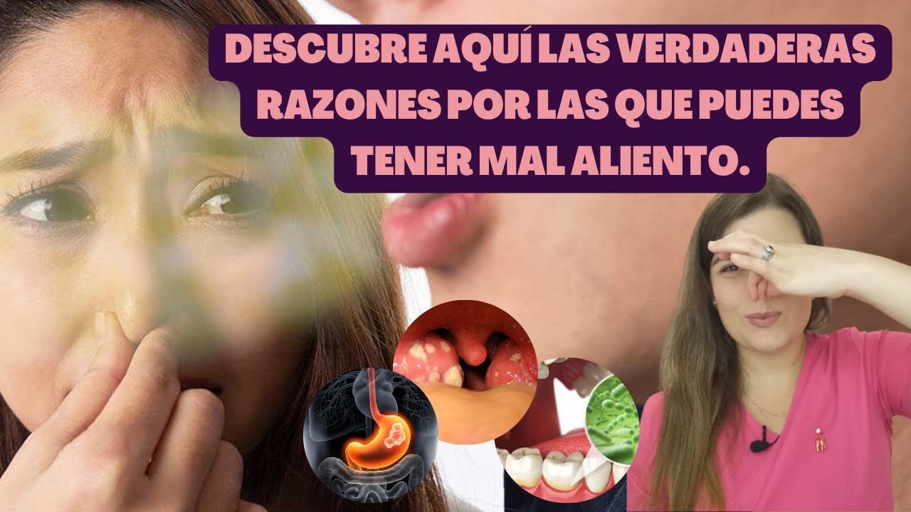 POR QUÉ tengo MAL ALIENTO aunque me lave los DIENTES 🤯🦷 [9 verdaderas CAUSAS 🙌]
