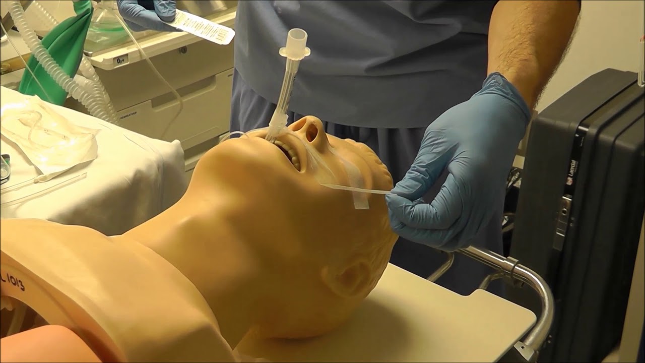 Securing an Endotracheal Tube