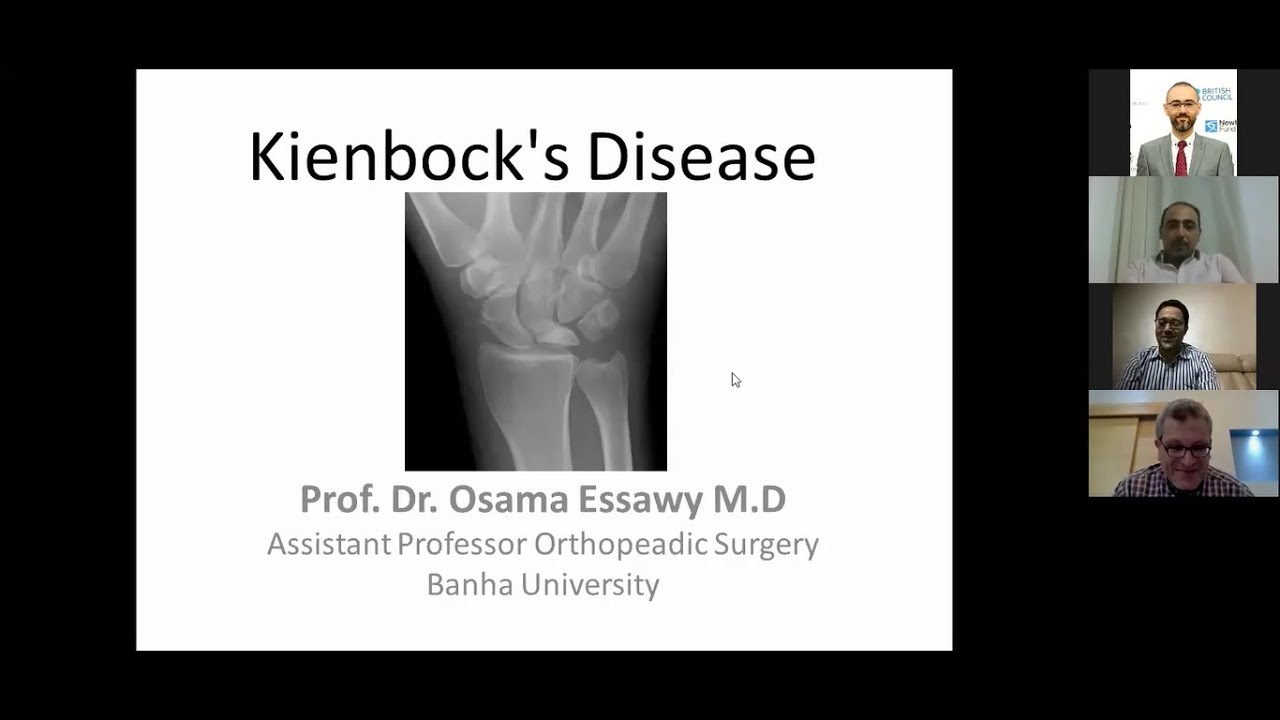 Kienbock's Disease ( Prof. Osama Essawy )