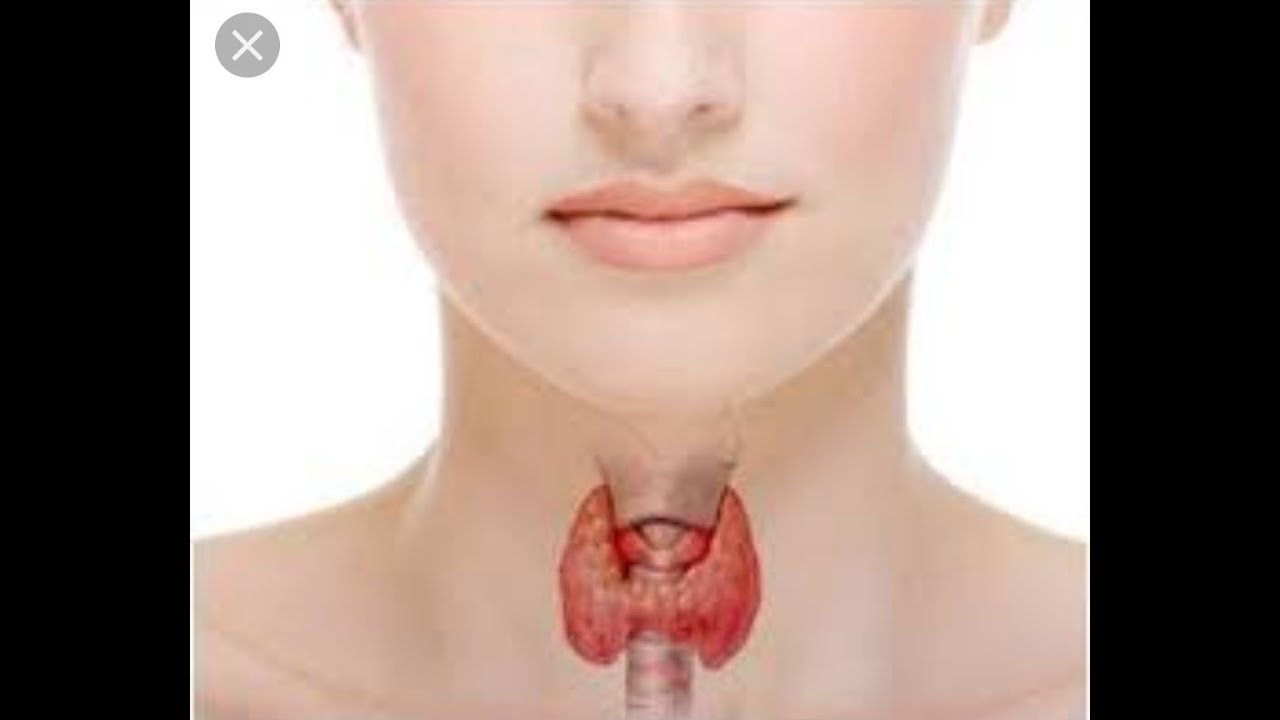 Wa dawadii thyroidk Kafaideysi Wacan