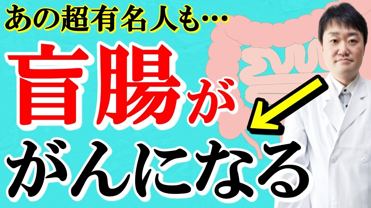 【手遅れ注意】盲腸がん・虫垂がんについて  大腸がんとの違いや初期症状、なった有名人、なりやすい人に関して消化器専門医がくわしく話します