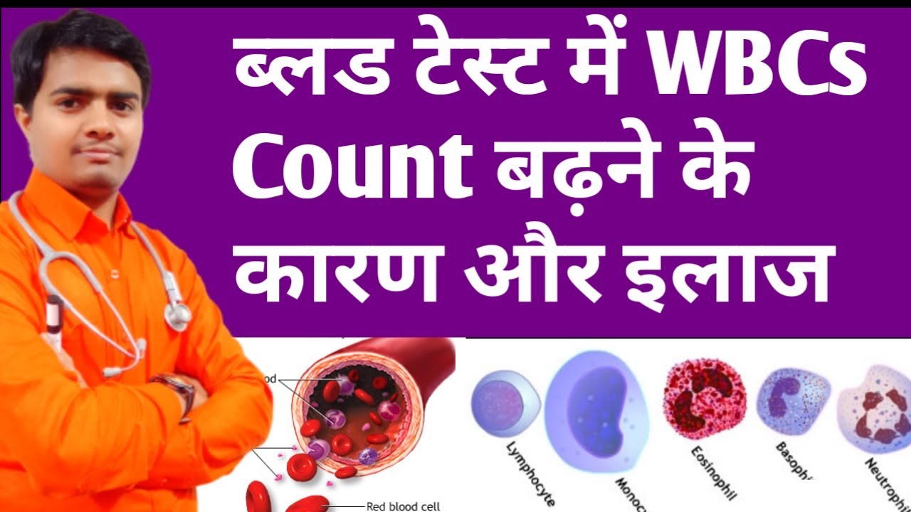 High Wbcs Count In Blood | ब्लड में WBCs बढ़ने के कारण और इलाज | High Wbc Count Treatment In Hindi