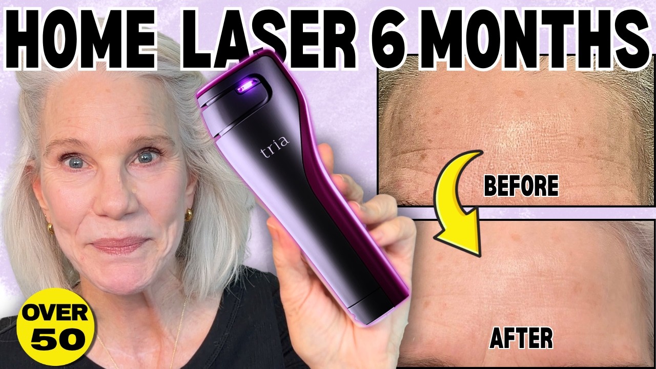 I Tried the TRIA Fractional Home Laser for 6 Months: Worth The 💰Money?