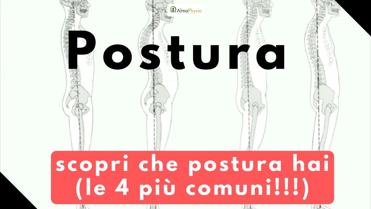 Postura corretta? Scopri che postura hai (LE 4 PIU COMUNI!!!)
