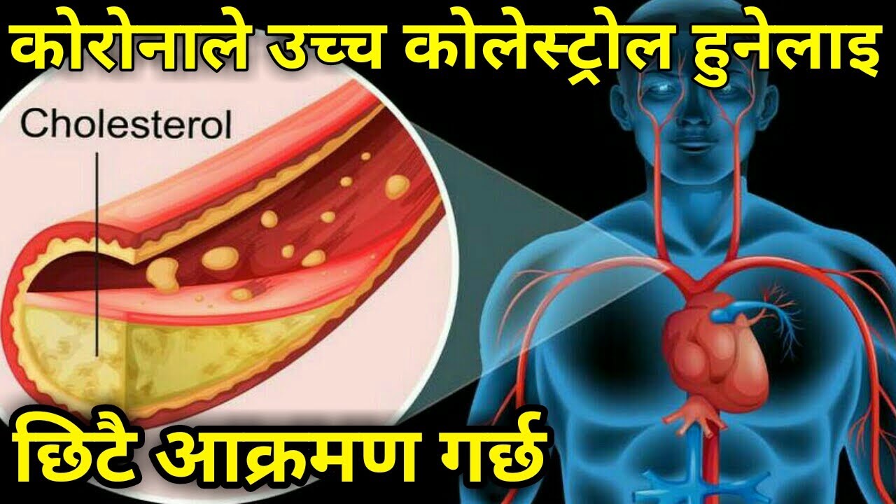 Nepali Health And Education Tips | कोरोनाले उच्च कोलेस्ट्रोल भएका मानिसलाइ यति छिटै आक्रमण गर्छ
