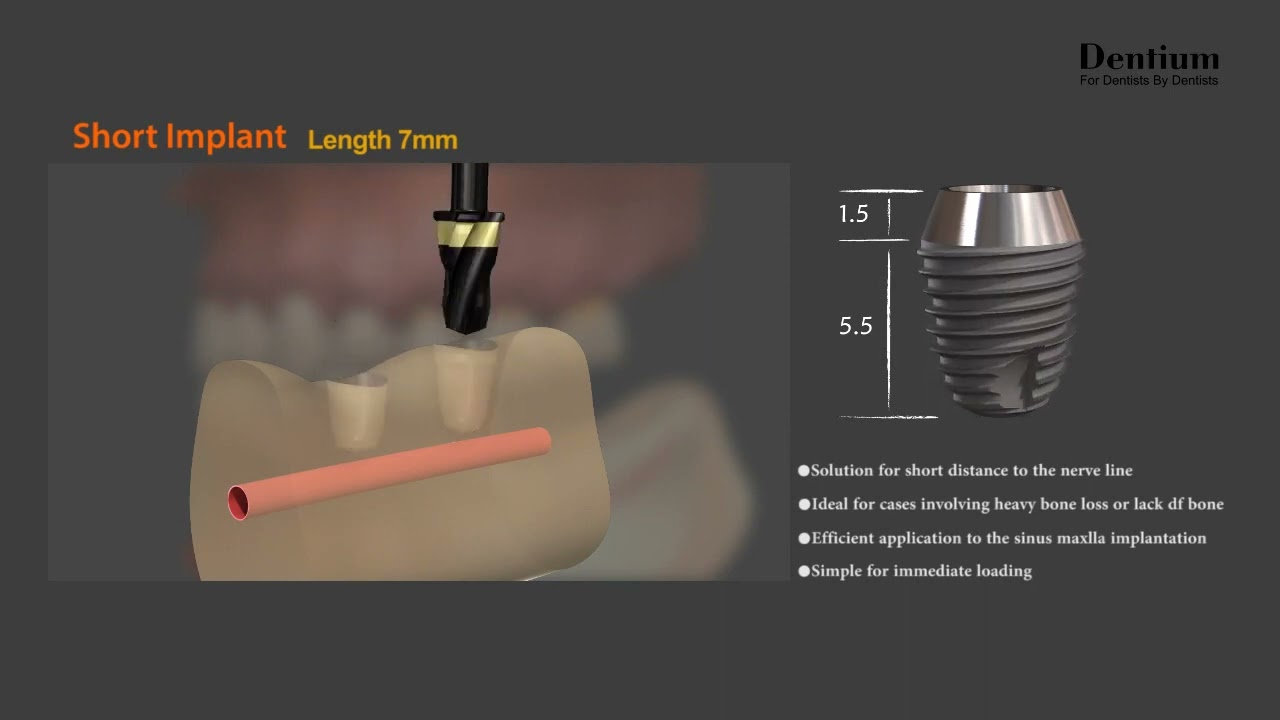 Dentium Short implant