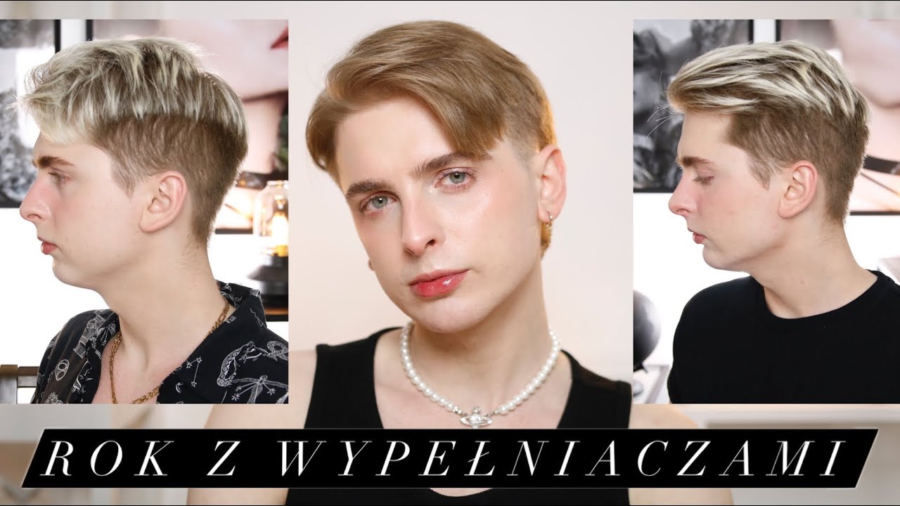 Jak wyglądają wypełniacze po roku? Czy było warto, Czy efekt nadal jest widoczny, Czy czegoś żałuje?