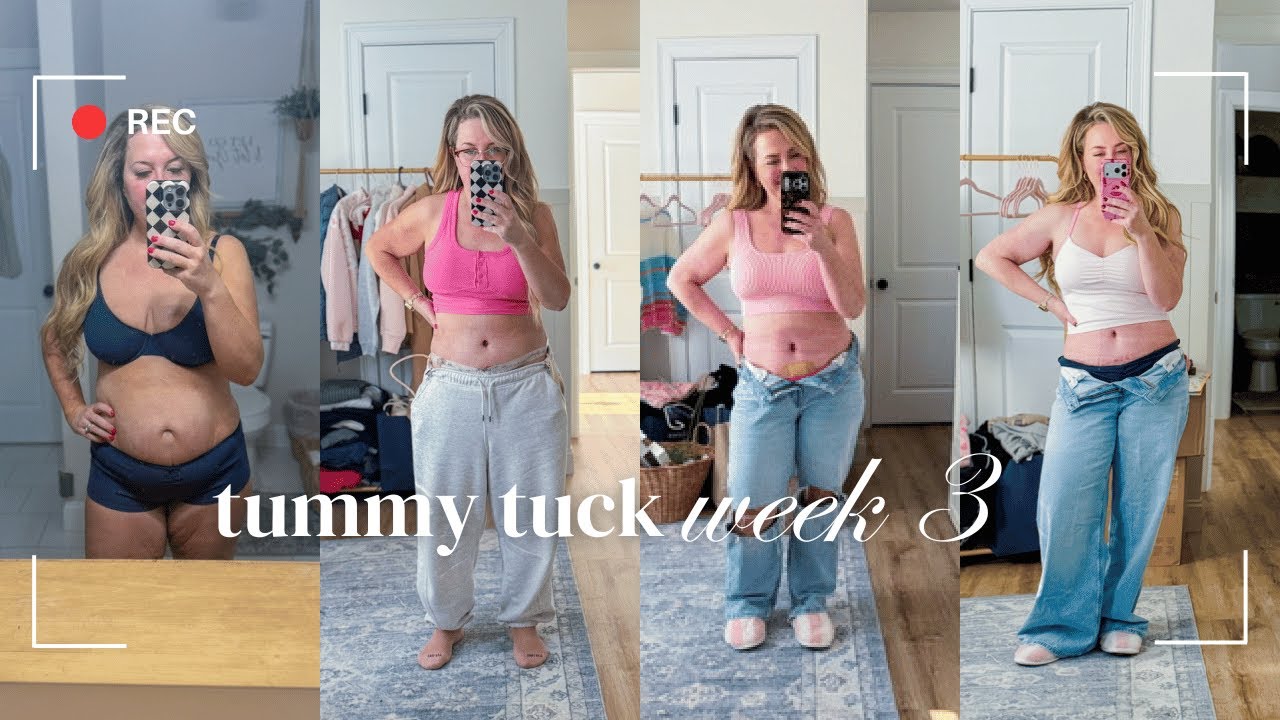 TUMMY TUCK UPDATE WEEK 3 // MOMMY MAKEOVER RECOVERY WEEK BY WEEK // CHARLOTTE GROVE FARMHOUSE