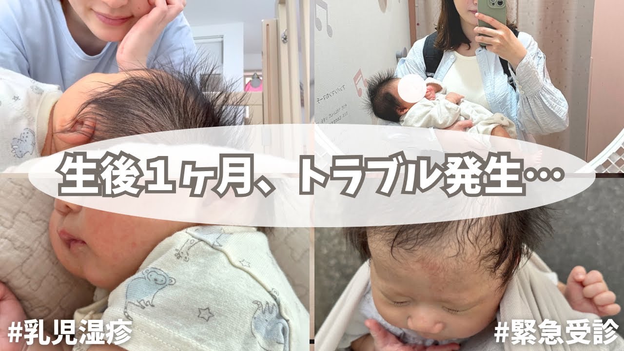 【生後1ヶ月】トラブル発生… | 乳児湿疹 | 緊急で受診した話 | １ヶ月健診 | 成長記録