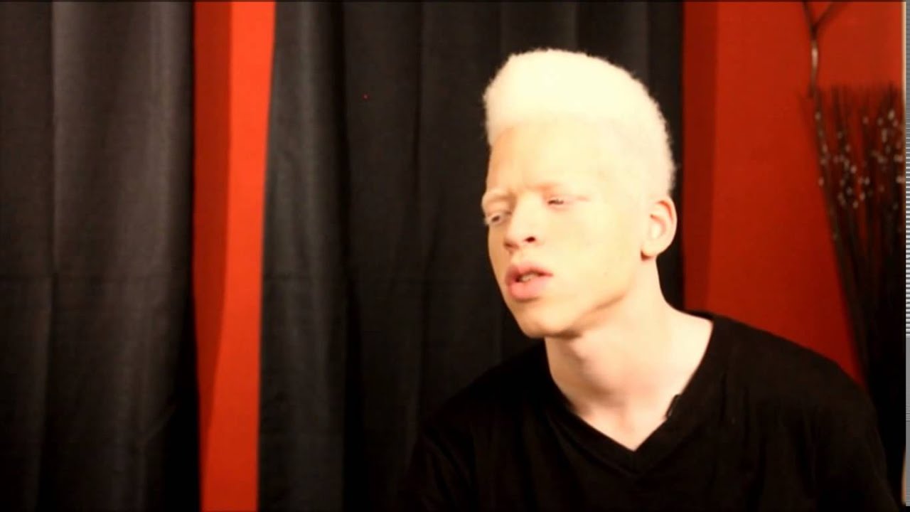 Albinism Awareness Campaign - Robdarius 