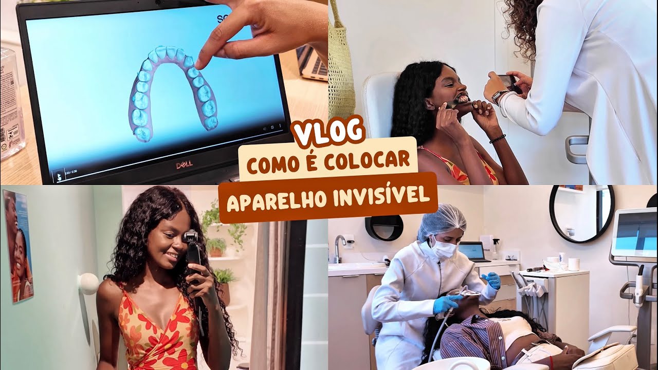 DAILY VLOG | VOLTE!! Coloquei o APARELHO INVISÍVEL da Sou Smile e mostrei todo o processo pra vocês