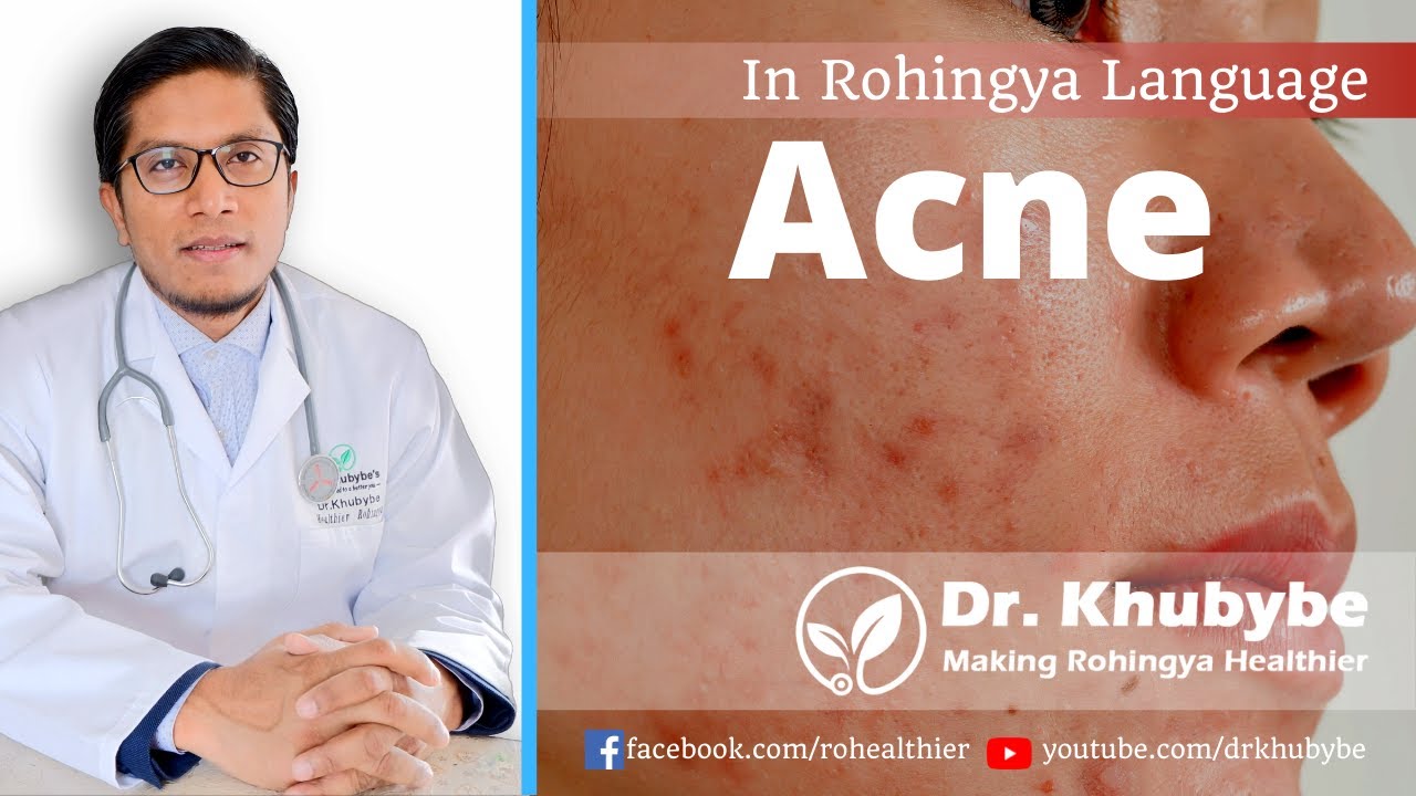 ACNE: HOW TO TREAT AT HOME (IN ROHINGYA LANGUAGE)