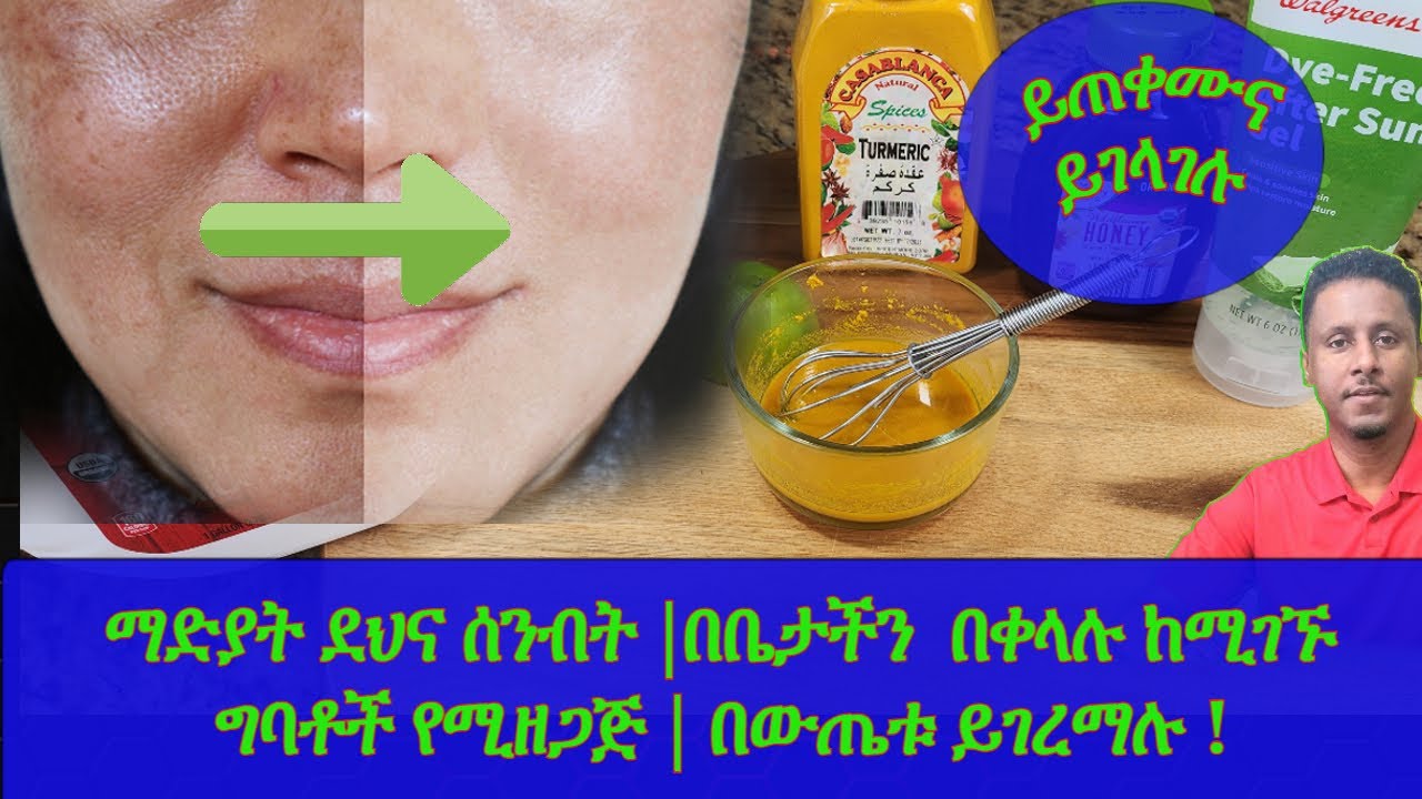 Ethiopia: ማድያት ደህና ሰንብት |በቤታችን  በቀላሉ ከሚገኙ ግባቶች የሚዘጋጅ | በውጤቱ ይገረማሉ !