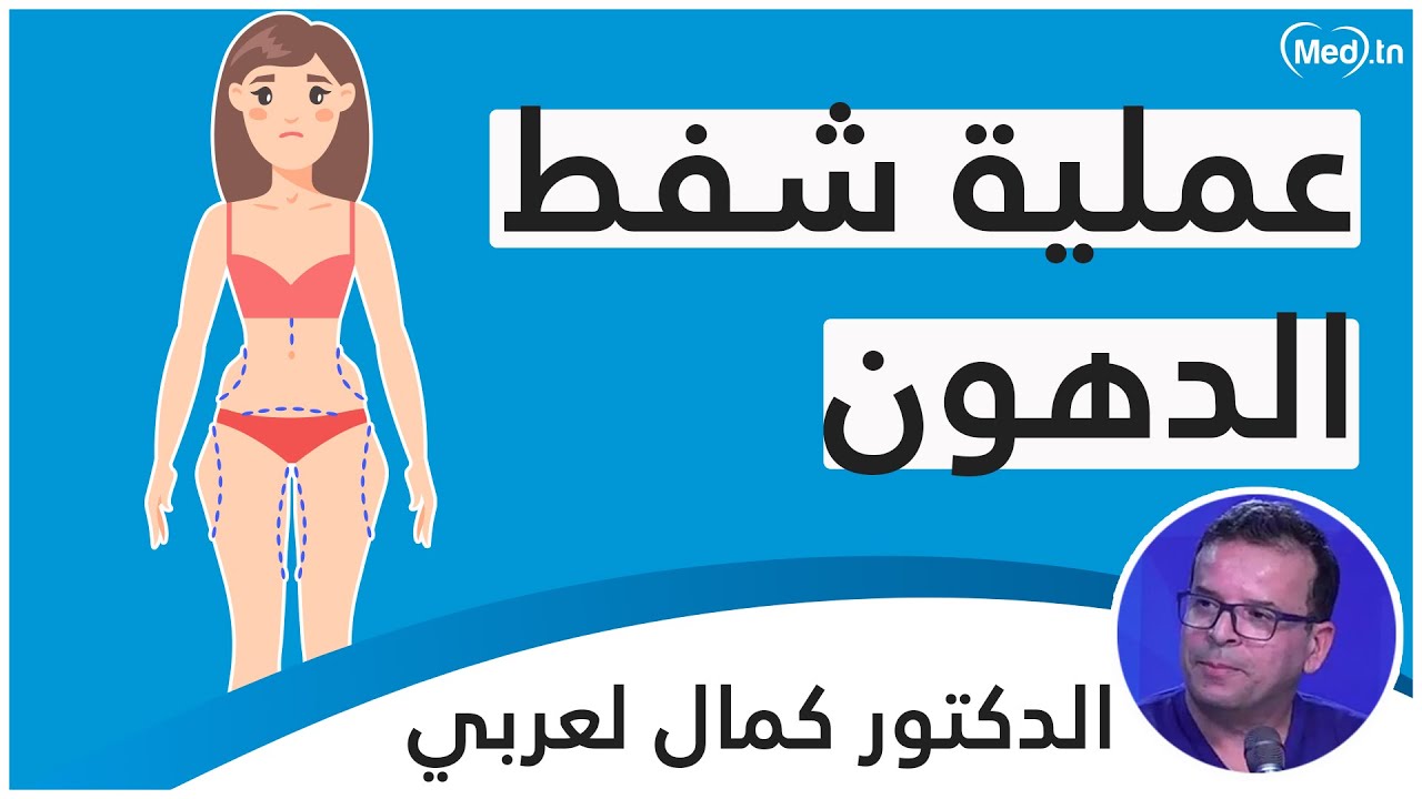 شفط الدهون  | الدكتور كمال لعربي