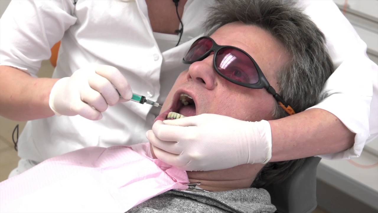 Painless Periodontitis treatment with the laser (Laser treatment at gingivitis) Part 1