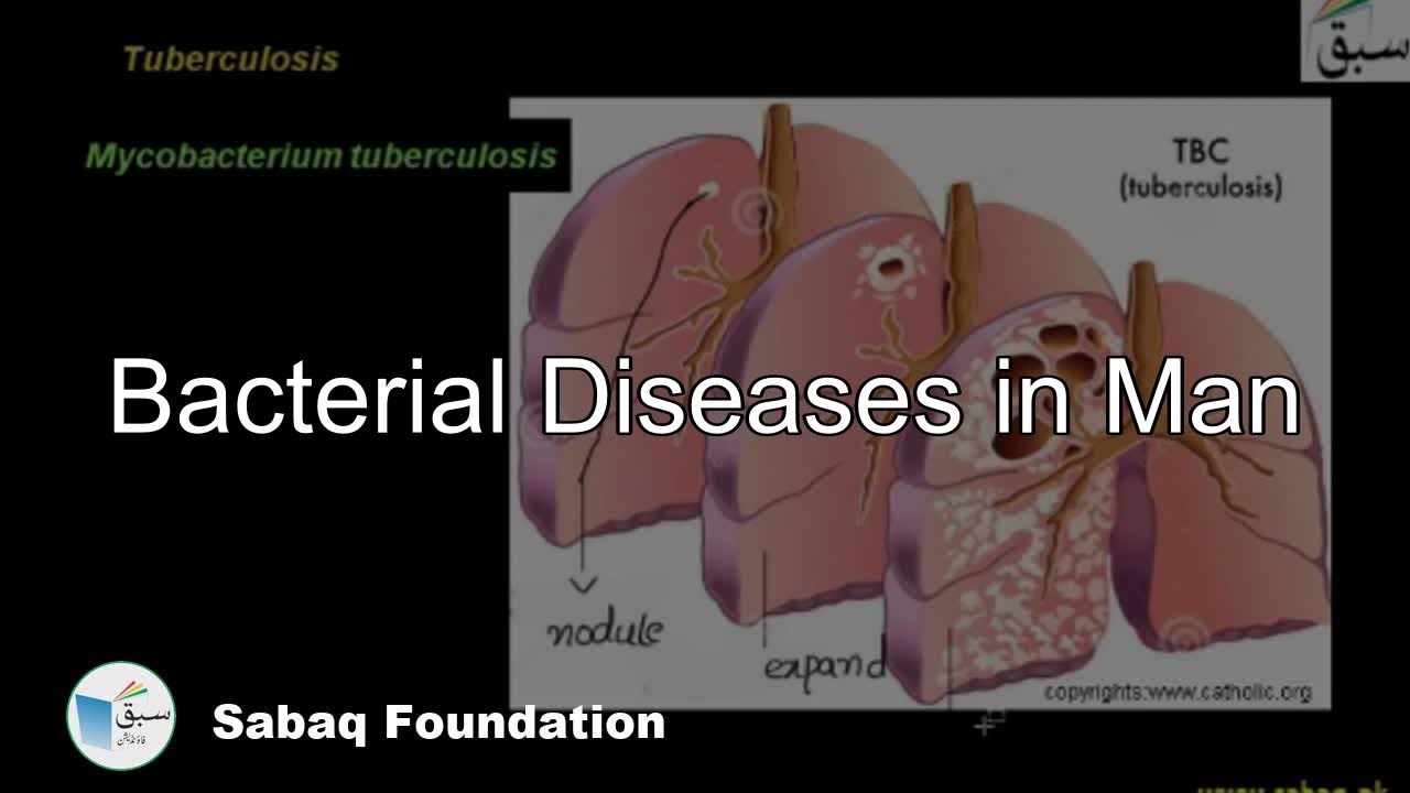 Bacterial Diseases in Man, Biology Lecture | Sabaq.pk