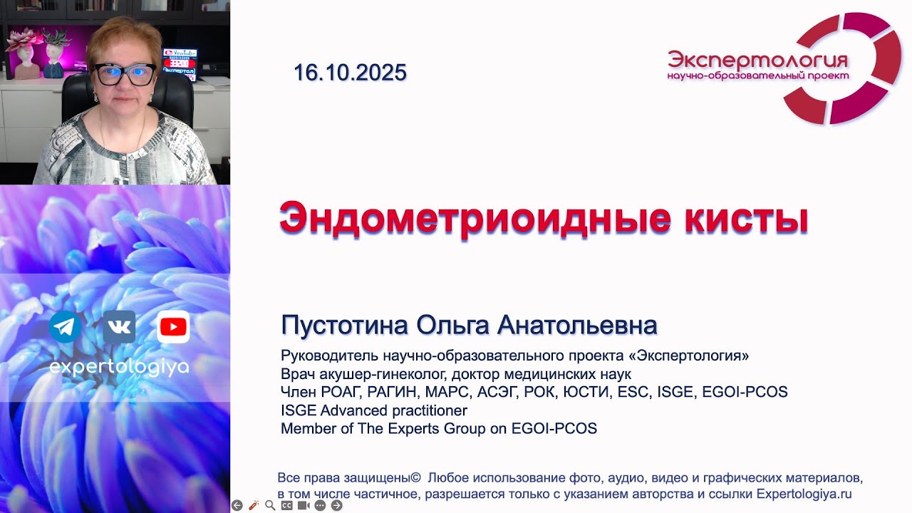 Эндометриоидные кисты l Пустотина О. А.