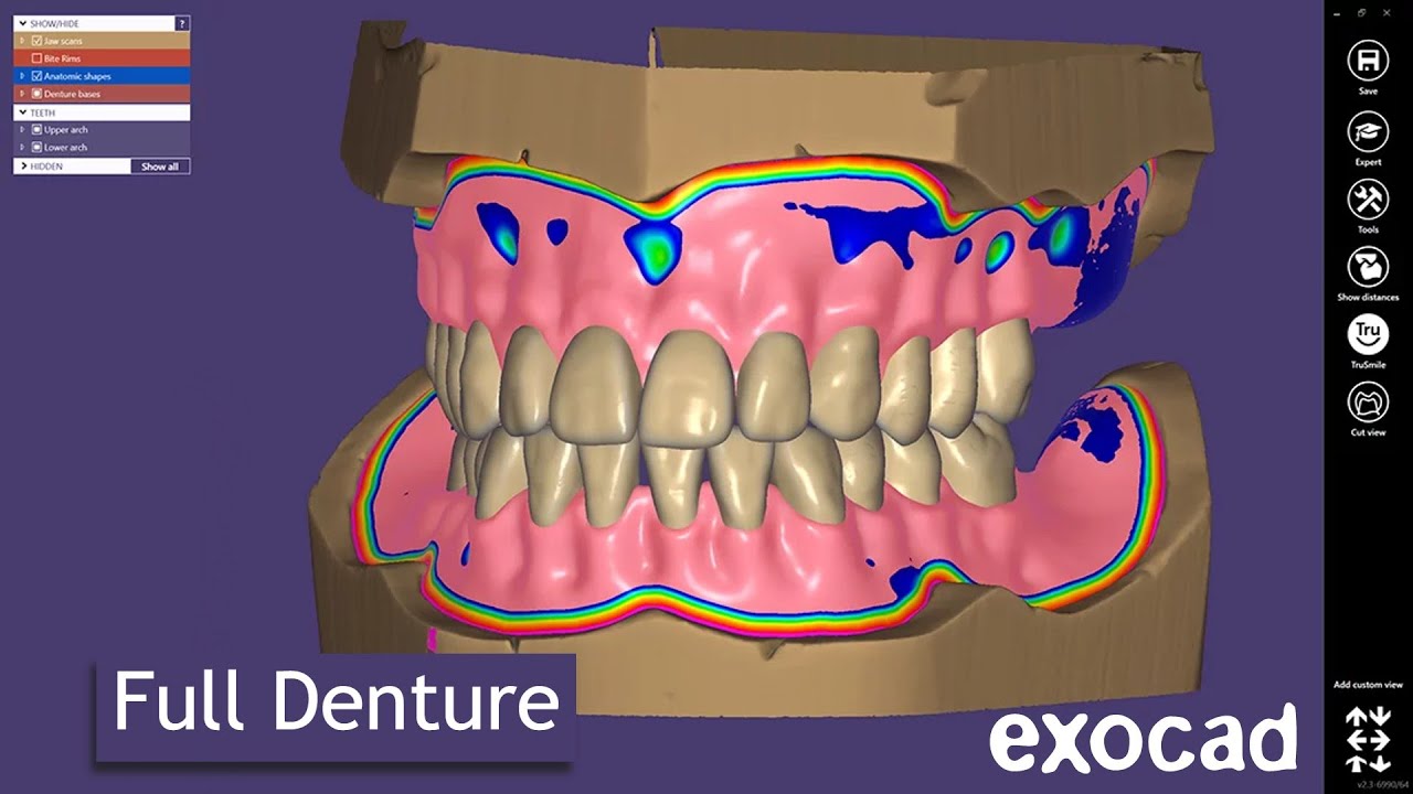 How to design a Full Denture in Exocad based on existing denture position.
